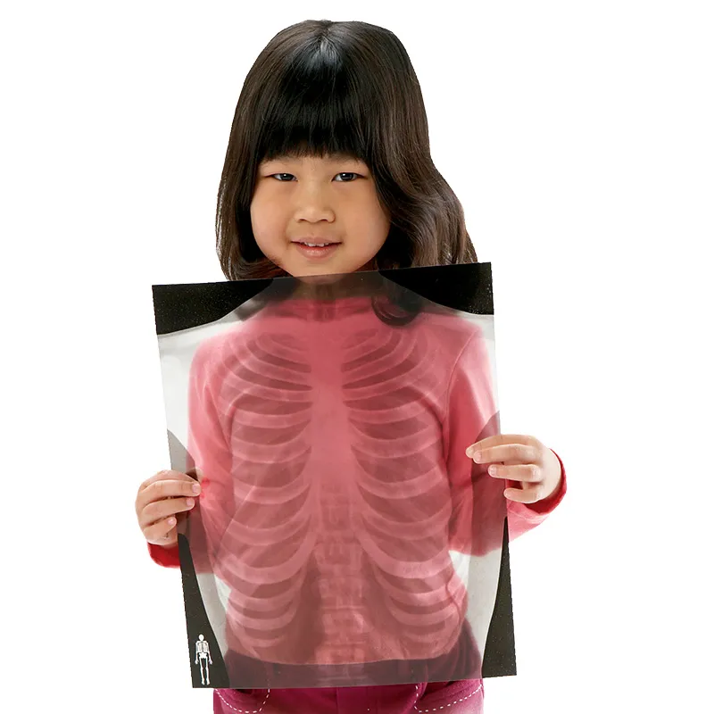 Röntgenbilder "Mensch", lebensgroß, 18-tlg.