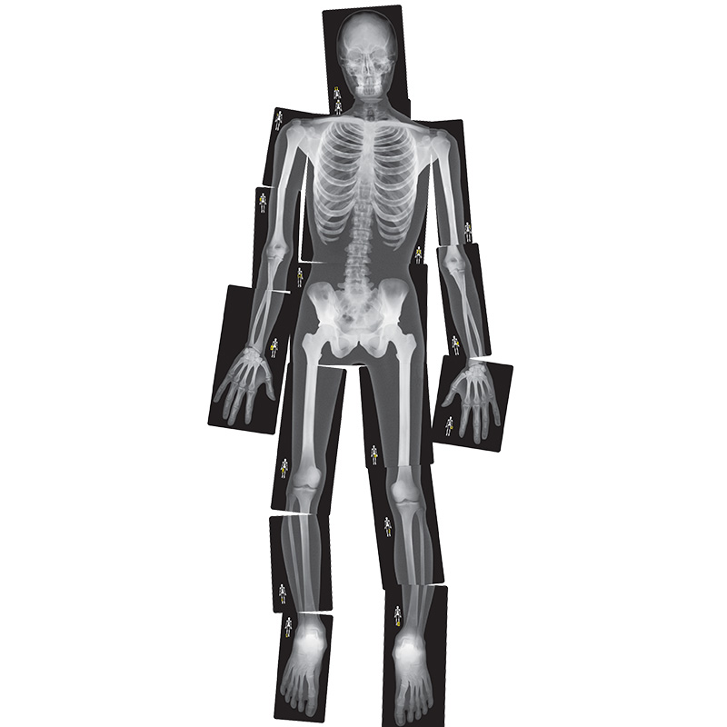 Imagini radiologice "corpul uman văzut cu raze X", mărime naturală, 18 buc.